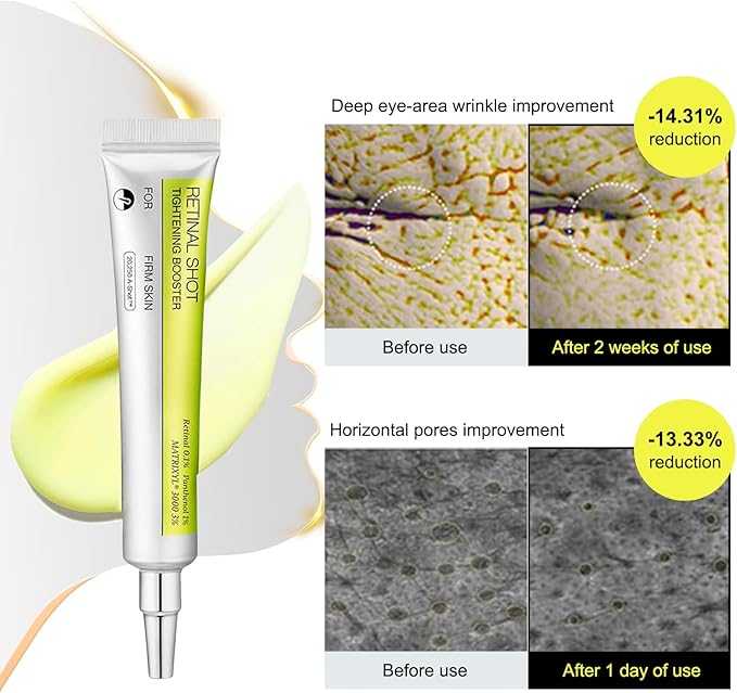 Retinol Shot Tightening Serum – Anti-Aging Skin Renewal Formula