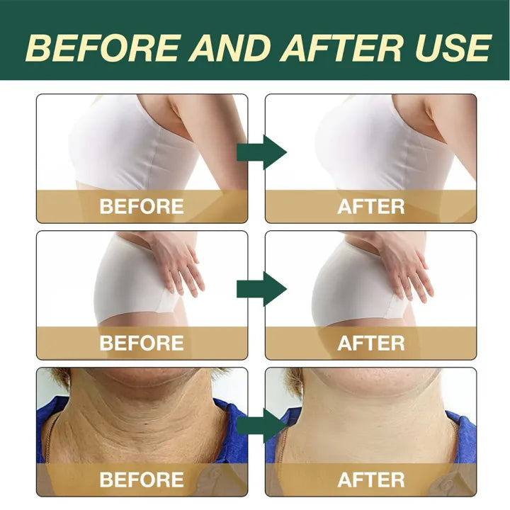 Collagen Boosting Body Oil – Firming, Hydrating &amp; Skin Nourishing Care