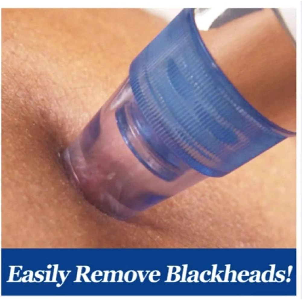 Pore Cleaning Device – Blackhead Remover Vacuum